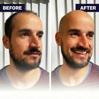 AirLock™ Edge Series